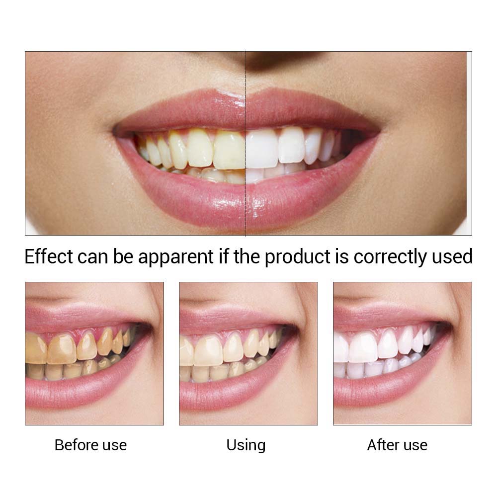 Teeth Whitening Essence